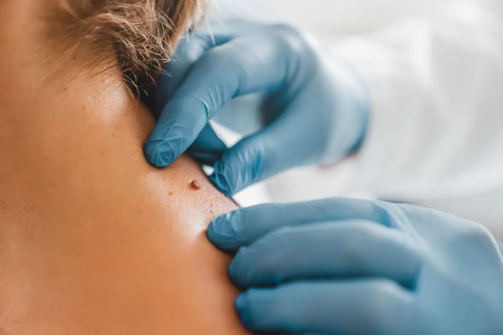 Dermatología Clínica